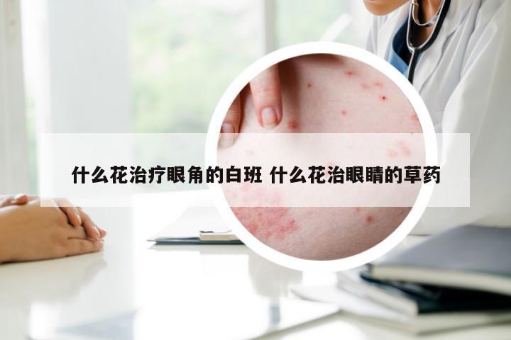 什么花治疗眼角的白班 什么花治眼睛的草药
