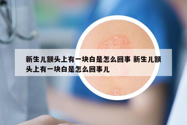 新生儿额头上有一块白是怎么回事 新生儿额头上有一块白是怎么回事儿