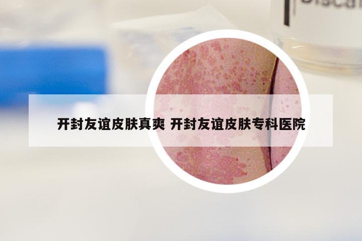 开封友谊皮肤真爽 开封友谊皮肤专科医院