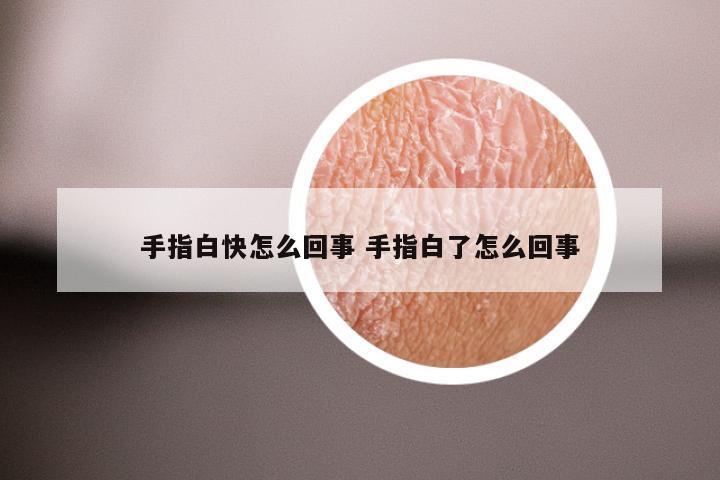 手指白快怎么回事 手指白了怎么回事