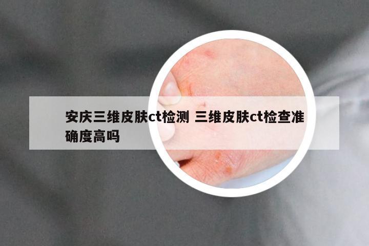 安庆三维皮肤ct检测 三维皮肤ct检查准确度高吗