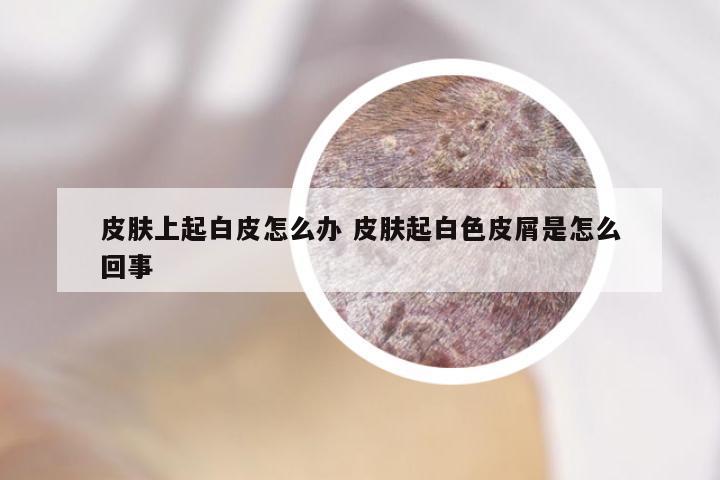 皮肤上起白皮怎么办 皮肤起白色皮屑是怎么回事