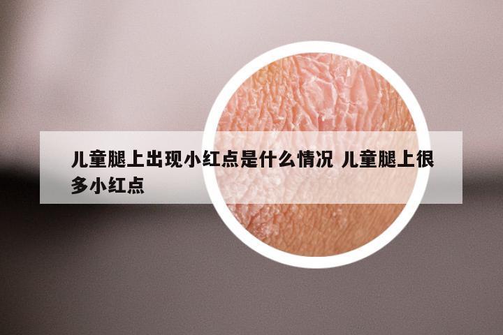 儿童腿上出现小红点是什么情况 儿童腿上很多小红点