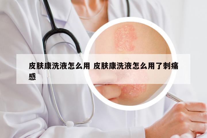 皮肤康洗液怎么用 皮肤康洗液怎么用了刺痛感