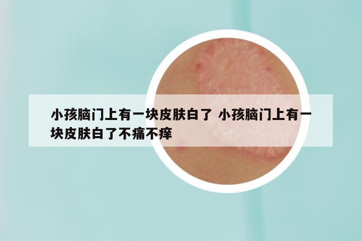 小孩脑门上有一块皮肤白了 小孩脑门上有一块皮肤白了不痛不痒
