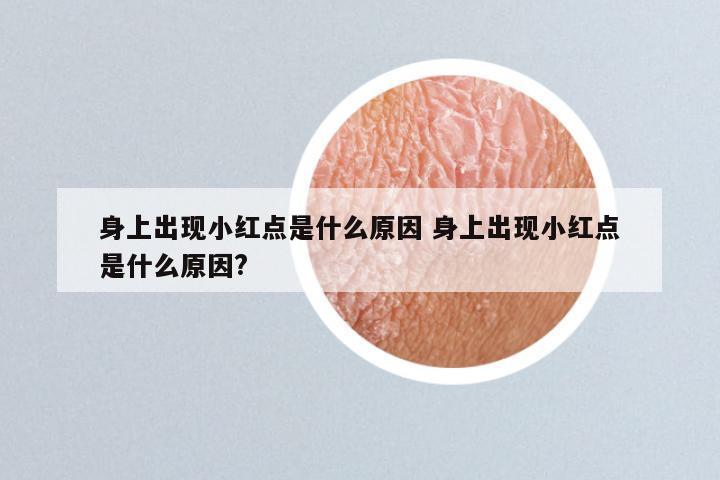身上出现小红点是什么原因 身上出现小红点是什么原因?