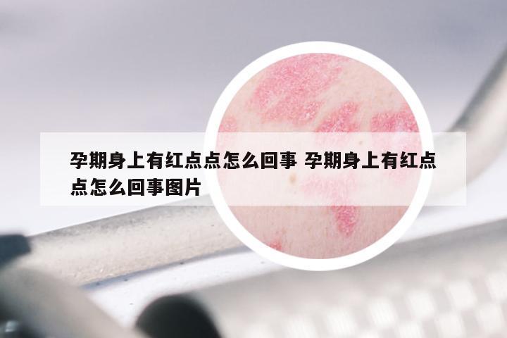 孕期身上有红点点怎么回事 孕期身上有红点点怎么回事图片