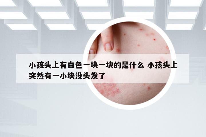 小孩头上有白色一块一块的是什么 小孩头上突然有一小块没头发了