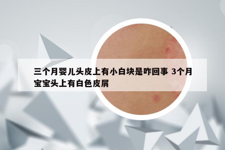 三个月婴儿头皮上有小白块是咋回事 3个月宝宝头上有白色皮屑