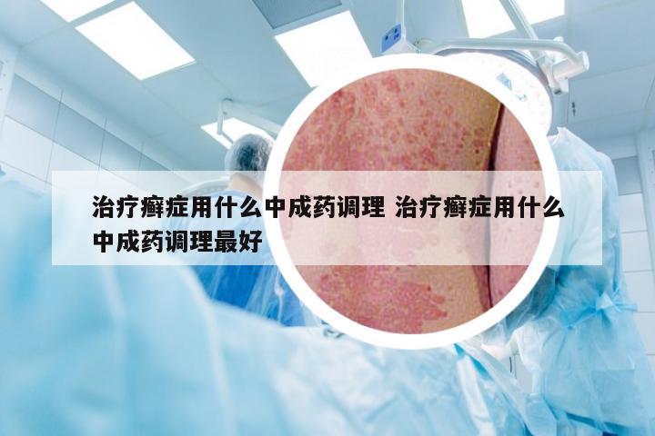 治疗癣症用什么中成药调理 治疗癣症用什么中成药调理最好