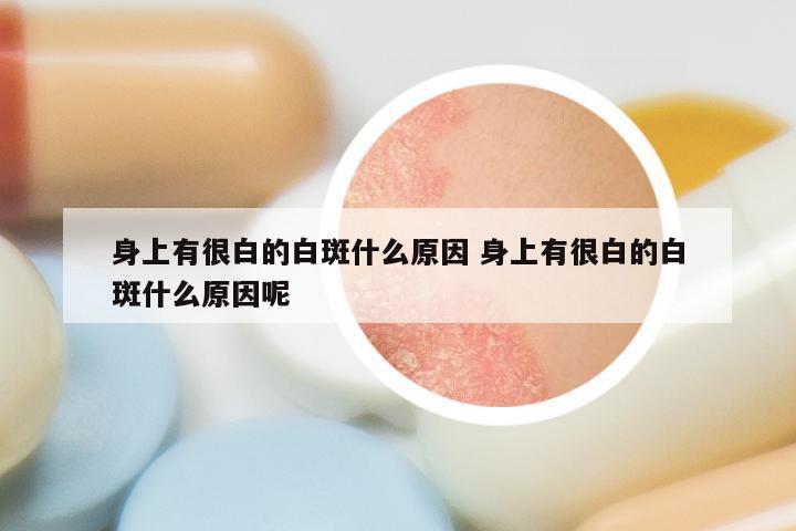 身上有很白的白斑什么原因 身上有很白的白斑什么原因呢