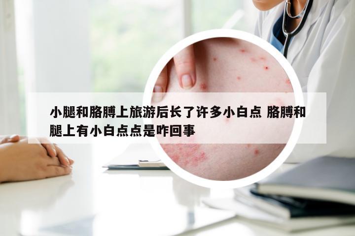 小腿和胳膊上旅游后长了许多小白点 胳膊和腿上有小白点点是咋回事