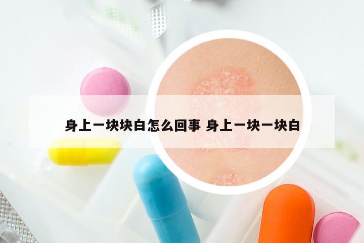 身上一块块白怎么回事 身上一块一块白