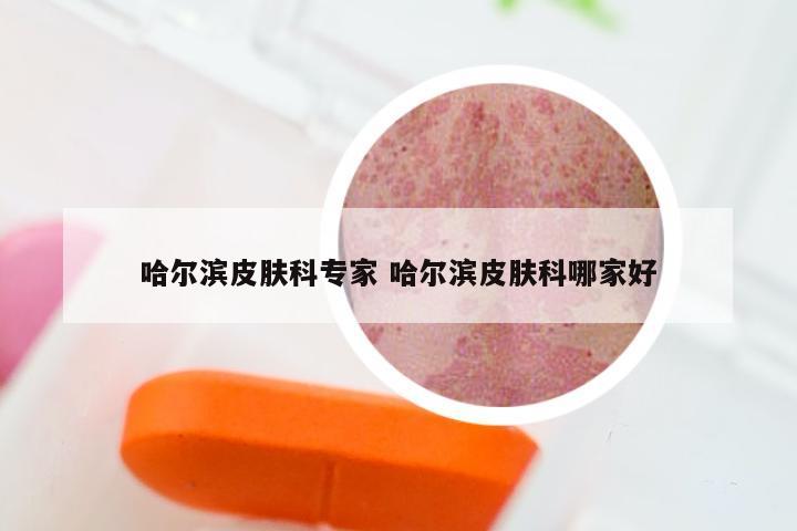 哈尔滨皮肤科专家 哈尔滨皮肤科哪家好