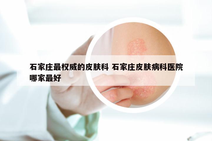 石家庄最权威的皮肤科 石家庄皮肤病科医院哪家最好