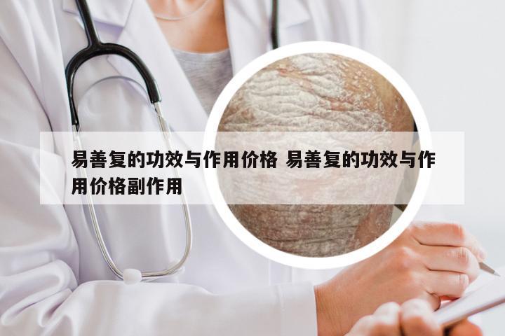 易善复的功效与作用价格 易善复的功效与作用价格副作用