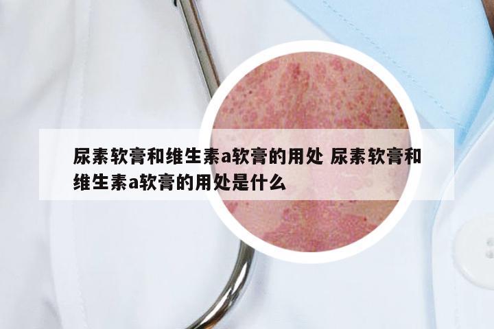 尿素软膏和维生素a软膏的用处 尿素软膏和维生素a软膏的用处是什么