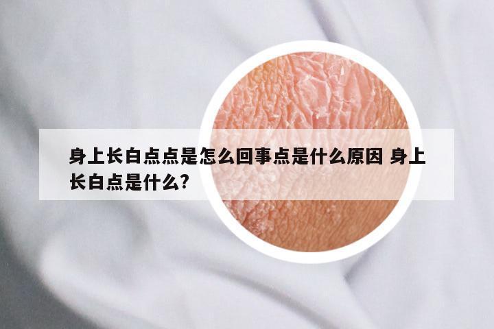 身上长白点点是怎么回事点是什么原因 身上长白点是什么?