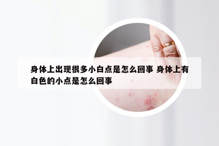 身体上出现很多小白点是怎么回事 身体上有白色的小点是怎么回事