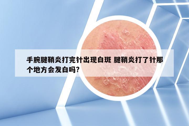 手腕腱鞘炎打完针出现白斑 腱鞘炎打了针那个地方会发白吗?