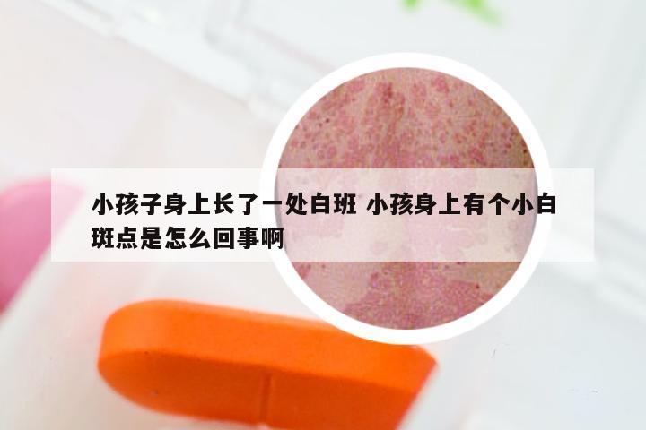 小孩子身上长了一处白班 小孩身上有个小白斑点是怎么回事啊