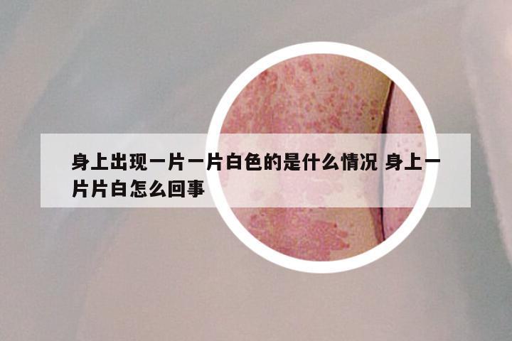 身上出现一片一片白色的是什么情况 身上一片片白怎么回事