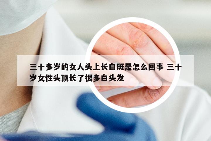 三十多岁的女人头上长白斑是怎么回事 三十岁女性头顶长了很多白头发