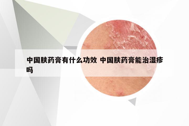 中国肤药膏有什么功效 中国肤药膏能治湿疹吗
