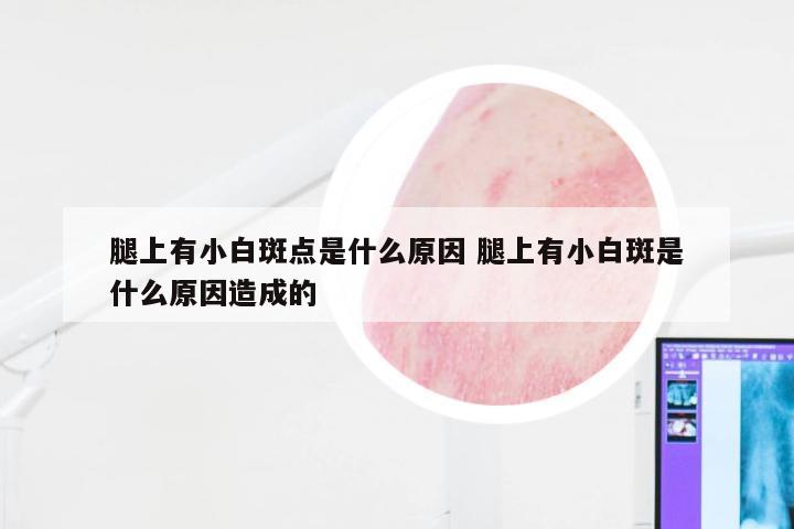 腿上有小白斑点是什么原因 腿上有小白斑是什么原因造成的