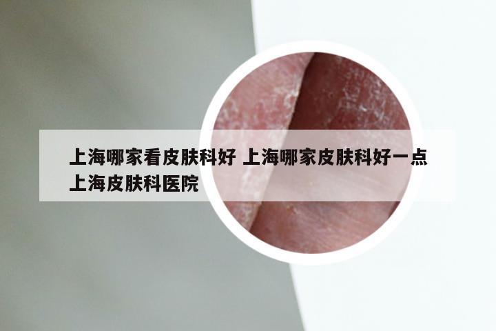 上海哪家看皮肤科好 上海哪家皮肤科好一点上海皮肤科医院