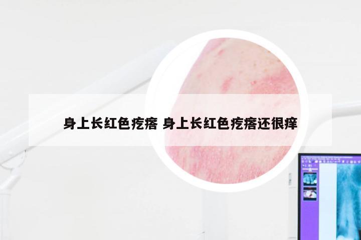 身上长红色疙瘩 身上长红色疙瘩还很痒