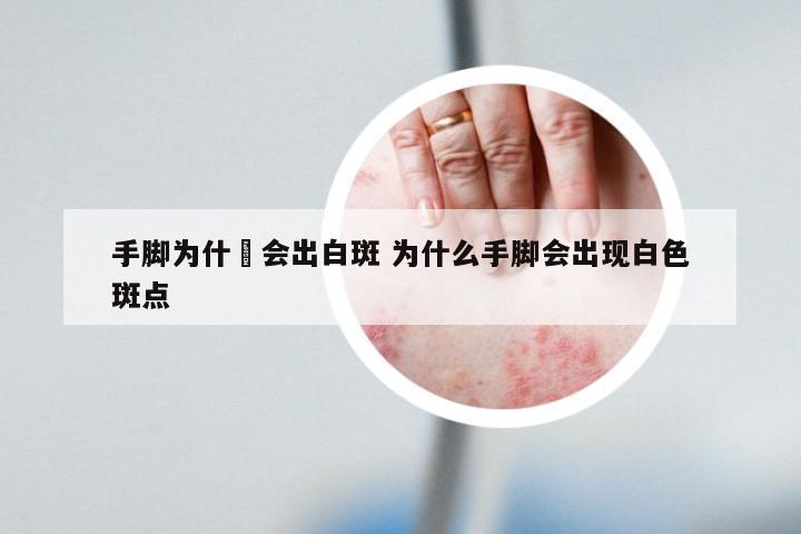 手脚为什麼会出白斑 为什么手脚会出现白色斑点