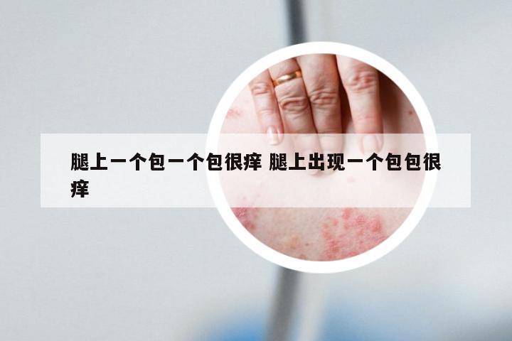 腿上一个包一个包很痒 腿上出现一个包包很痒