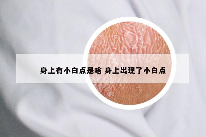 身上有小白点是啥 身上出现了小白点