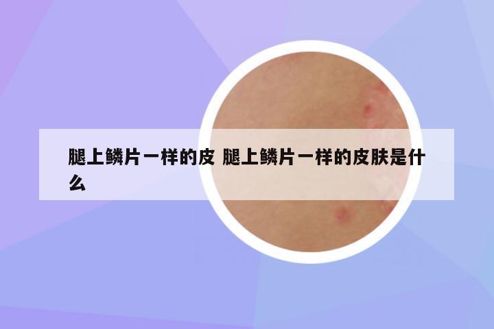 腿上鳞片一样的皮 腿上鳞片一样的皮肤是什么