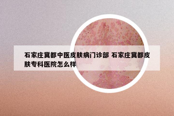 石家庄冀都中医皮肤病门诊部 石家庄冀都皮肤专科医院怎么样