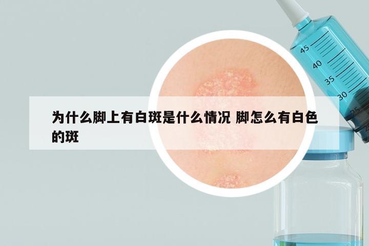 为什么脚上有白斑是什么情况 脚怎么有白色的斑