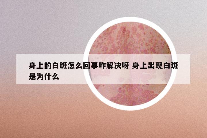 身上的白斑怎么回事咋解决呀 身上出现白斑是为什么