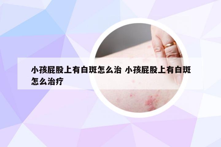 小孩屁股上有白斑怎么治 小孩屁股上有白斑怎么治疗