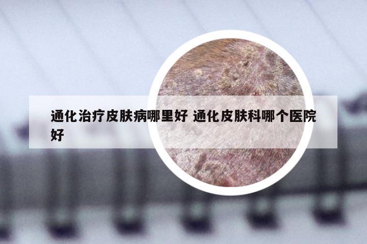 通化治疗皮肤病哪里好 通化皮肤科哪个医院好
