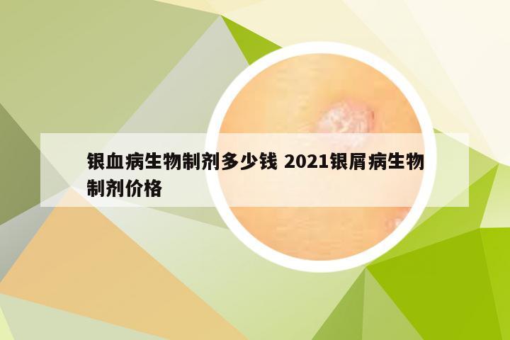 银血病生物制剂多少钱 2021银屑病生物制剂价格