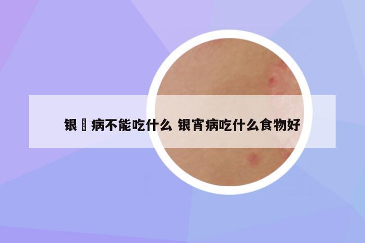 银痟病不能吃什么 银宵病吃什么食物好