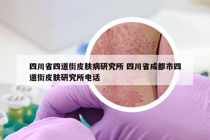 四川省四道街皮肤病研究所 四川省成都市四道街皮肤研究所电话