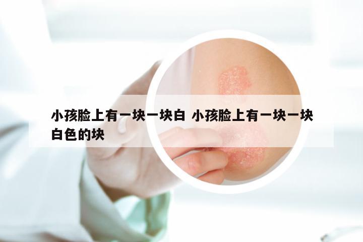 小孩脸上有一块一块白 小孩脸上有一块一块白色的块