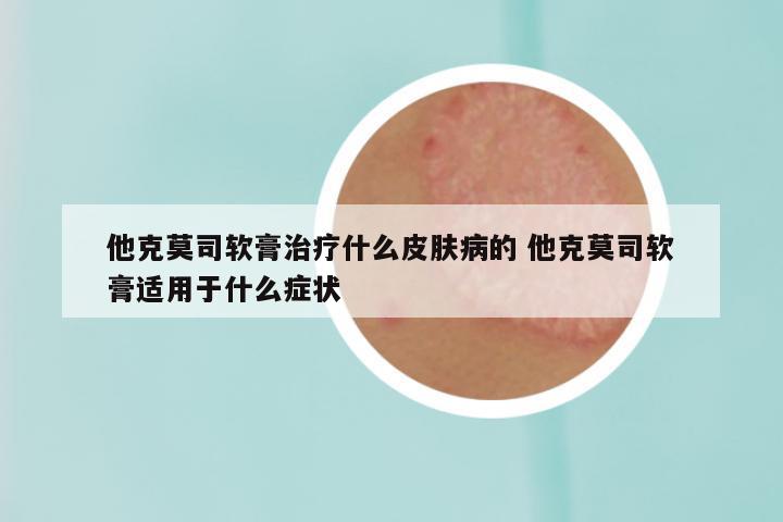 他克莫司软膏治疗什么皮肤病的 他克莫司软膏适用于什么症状
