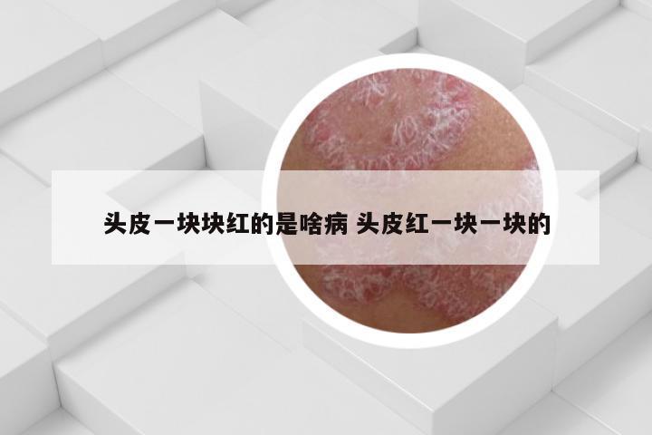 头皮一块块红的是啥病 头皮红一块一块的