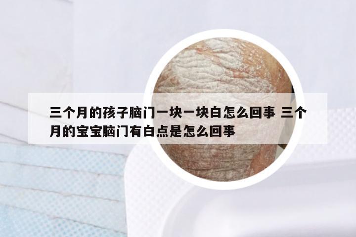 三个月的孩子脑门一块一块白怎么回事 三个月的宝宝脑门有白点是怎么回事