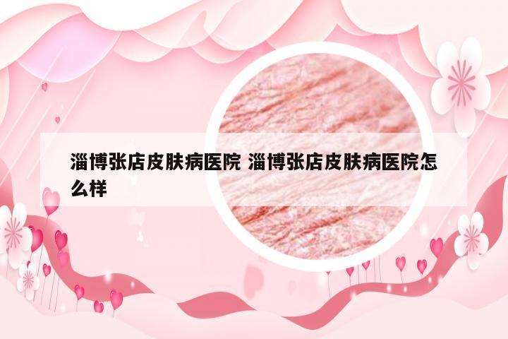 淄博张店皮肤病医院 淄博张店皮肤病医院怎么样