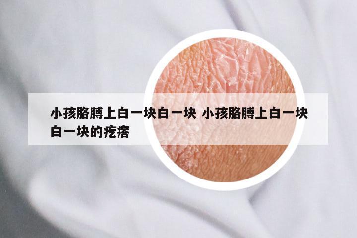 小孩胳膊上白一块白一块 小孩胳膊上白一块白一块的疙瘩