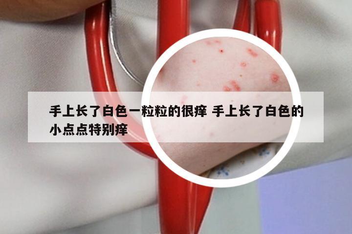 手上长了白色一粒粒的很痒 手上长了白色的小点点特别痒